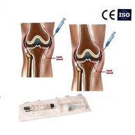 Injeção na articulação do joelho em gel de ácido hialurônico